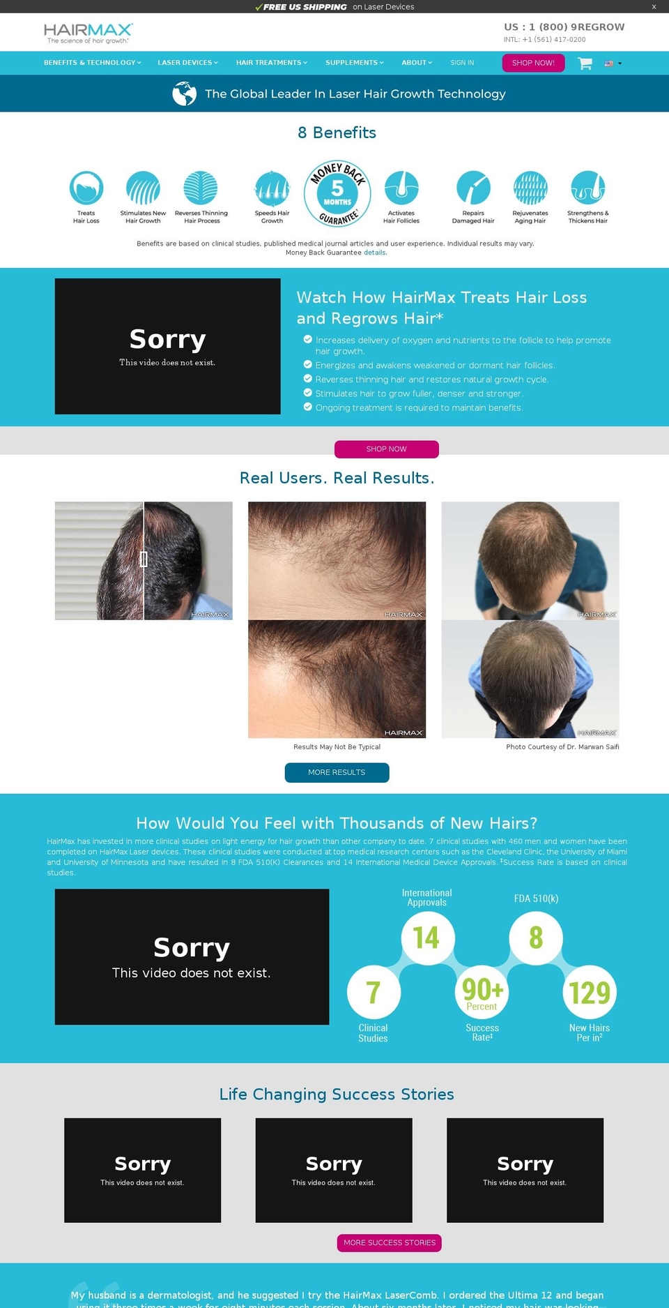 hairlosshelp.eu shopify website screenshot