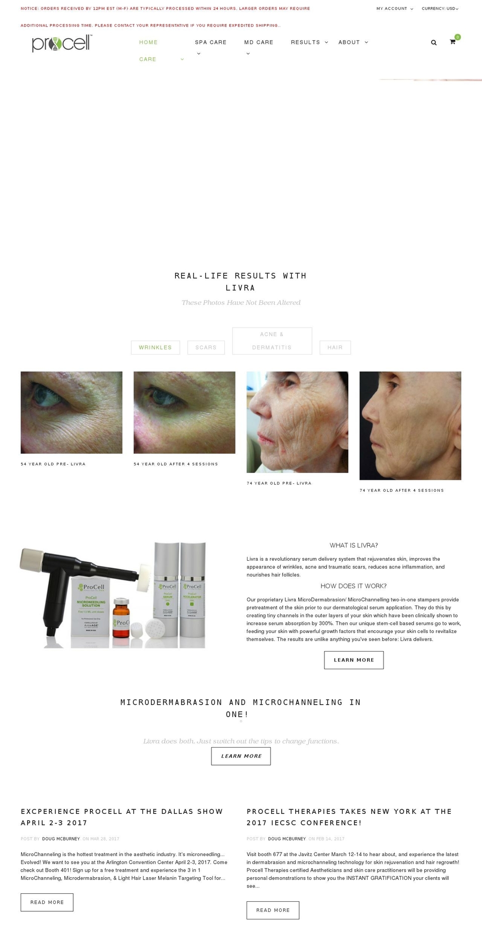 bazien-layout-1 Shopify theme site example procellmicroneedling.com