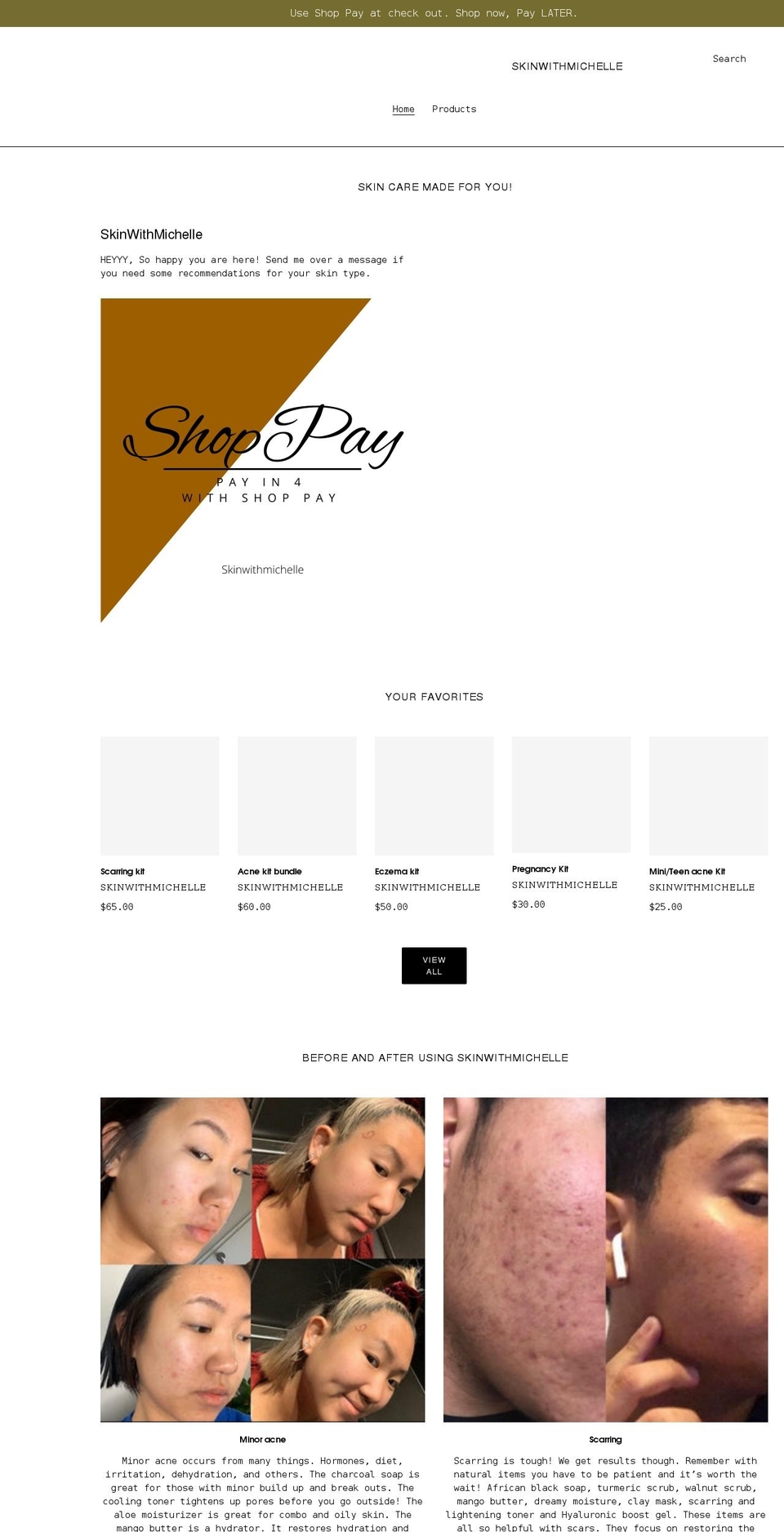 skinwithmichelle.com shopify website screenshot